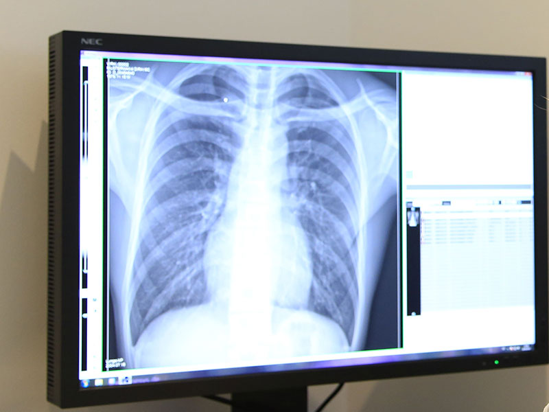 Volldigitale Röntgendiagnostik